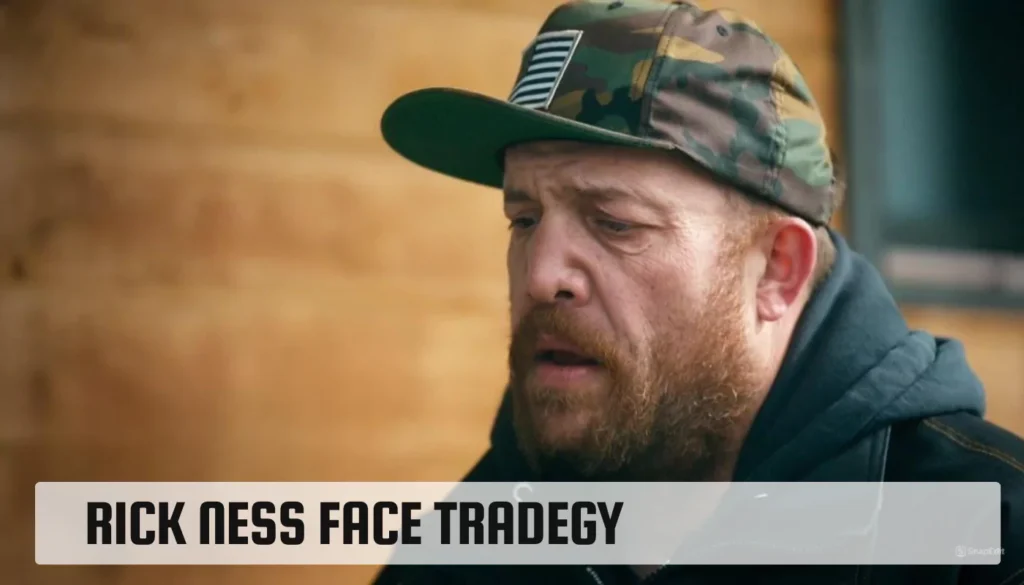 What Happen to Rick Ness Face