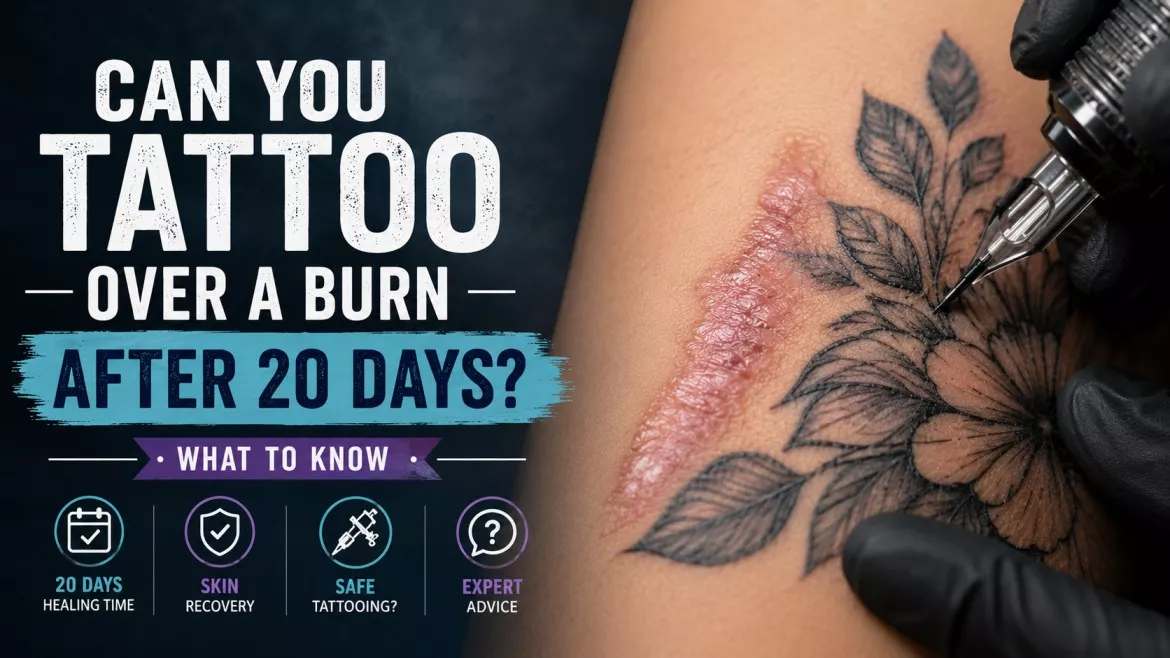 Can You Tattoo Over a Burn After 20 Days